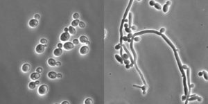 candida-untreated